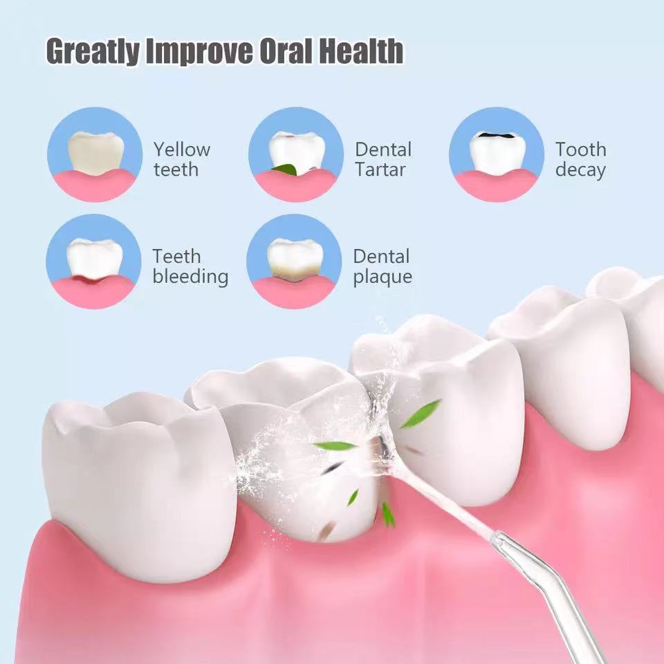 Waterproof Irrigator Dental Cleaner by Queendom